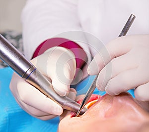 DentistÃ¢â¬â¢s hands with gloves and tools in a patient`s mouth photo